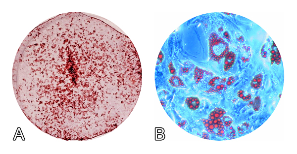 Fotomicrografia de cultura de células-tronco mesenquimais. Formação de matriz extracelular mineralizada em cultura de células-tronco mesenquimais derivadas de medula óssea, crescidas em condições osteogênicas (A). Formação de acúmulo lipídico em cultura de células-tronco mesenquimais derivadas de tecido adiposo, crescidas em condições adipogênicas (Imagem: Rodrigo Paolo Flores Abuna)
